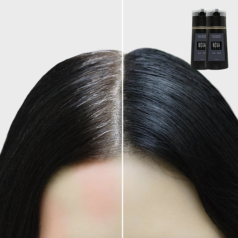 Skanto | Color Shampoo Black and Brown Shades 5